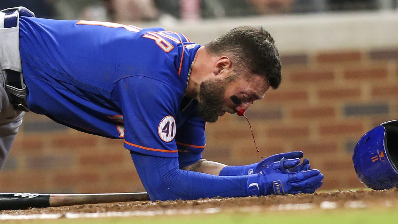 Mets OF Kevin Pillar takes 94mph fastball to face