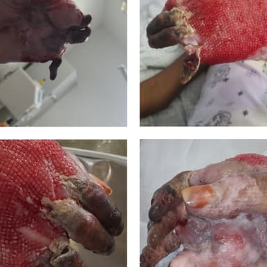 Chirurgie reconstruction