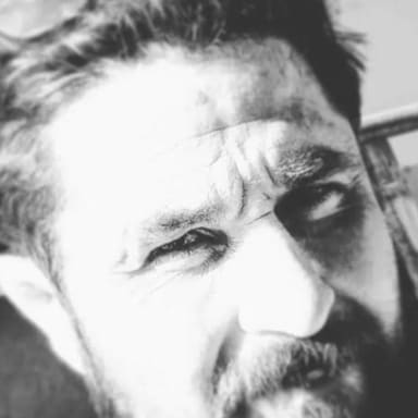 soutient à Sébastien, charpentier qui a perdu ses doigts suite a un accident