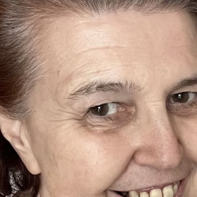 Marielle combat contre le cancer