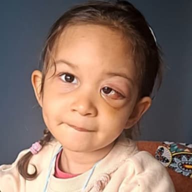 Une chance à la vie pour la petite Noelia