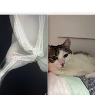 Abandonnée avec une fracture ouverte Nour a besoin d aide