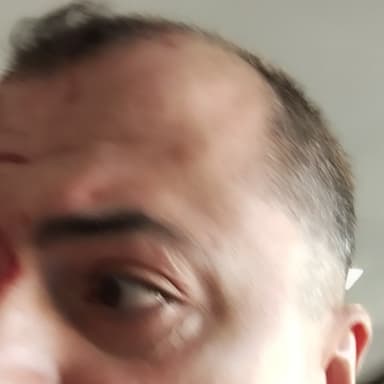 SOLIDARITÉ AVEC NABIL HAMOUCHE GRIÈVEMENT BLESSÉ DANS UN ACCIDENT