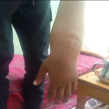 Aidons le jeune Ylyass dans son combat contre le cancer.