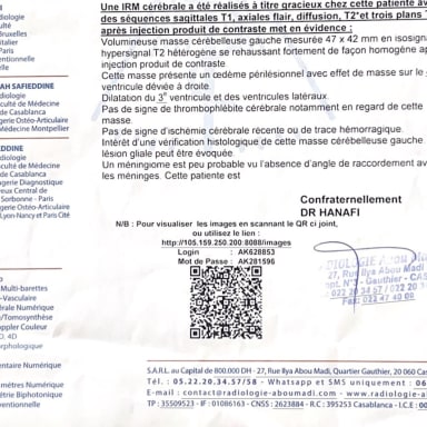 Aidons notre grand mère à lutter contre sa tumeur au cerveau