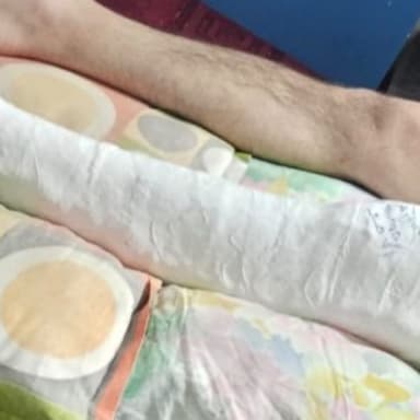Opération  genou urgente à broche