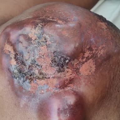 Pour ma mère atteinte de cancer du sein.