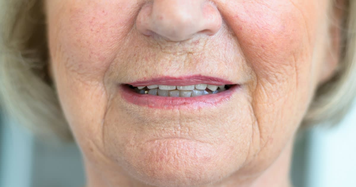 Senior Dental Care: 7 Surprising Dangers of Poor Dental Health