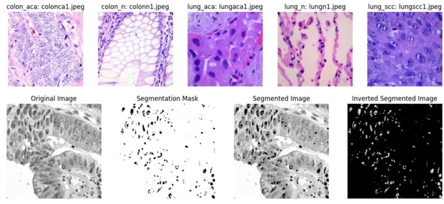 Lung and colon histopathology image-enhancement and transfer-learning workflow