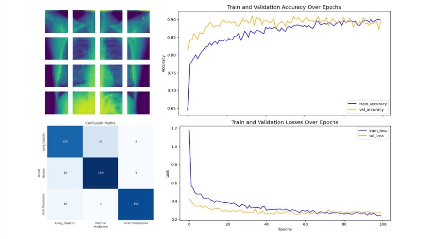 Medical image preprocessing and Vision Transformer classification workflow