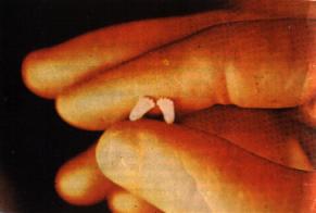 No all'aborto - Walter Sulla