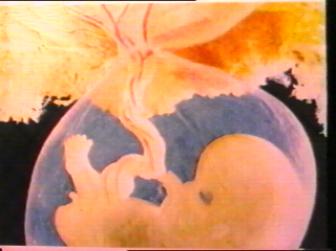 No all'aborto - Walter Sulla