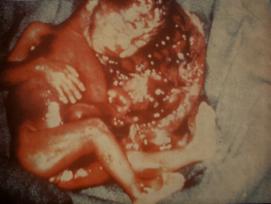 No all'aborto - Walter Sulla