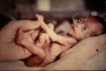 No all'aborto - Walter Sulla