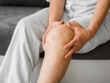 Varicose-vein-treatment-at-HeartCare-Texas-in-North-Richland-Hills-and-Weatherford