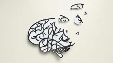 tms-for-cognitive-decline-shore-clinical-wellness-center