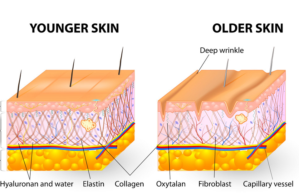 Bilde viser de forskjellige lagene i huden.