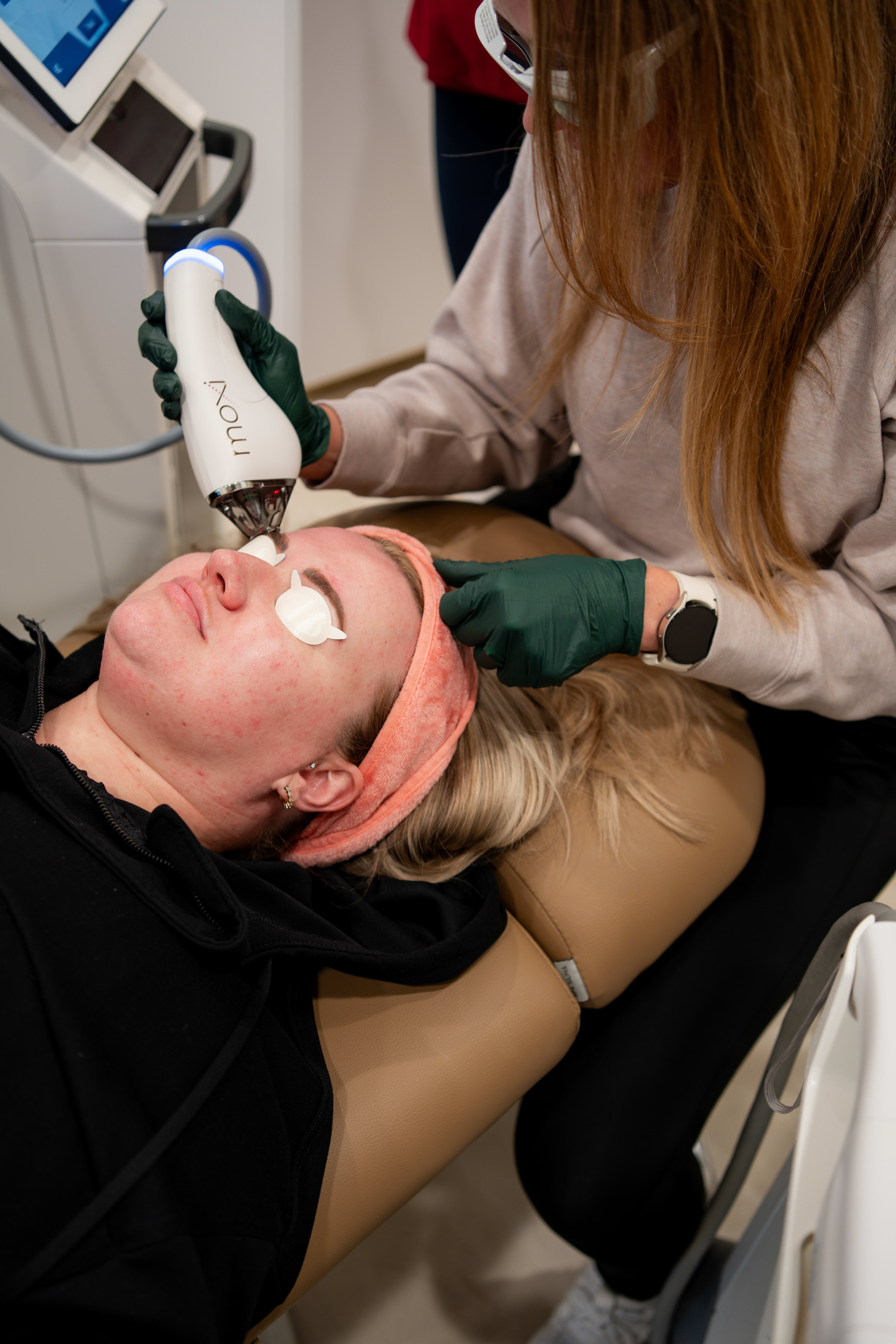 Microneedling