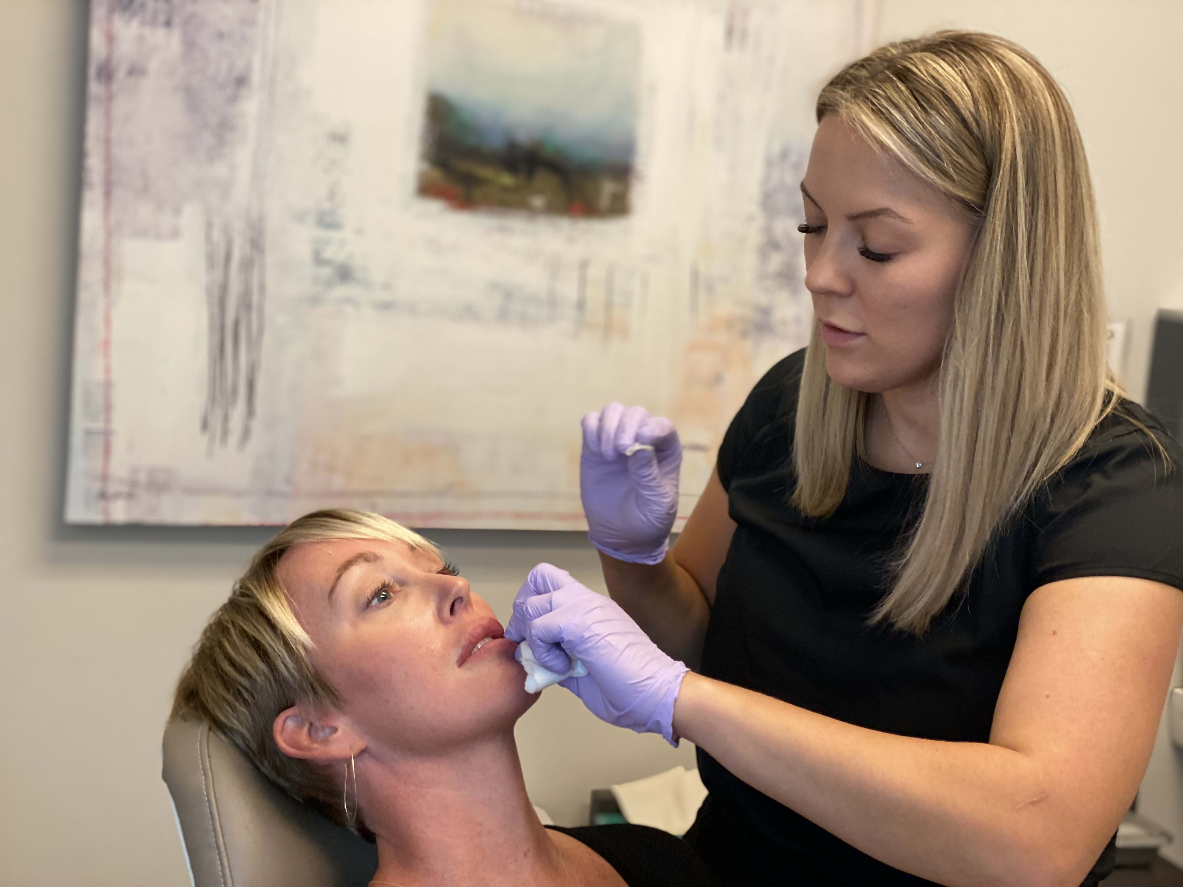 Lip Filler