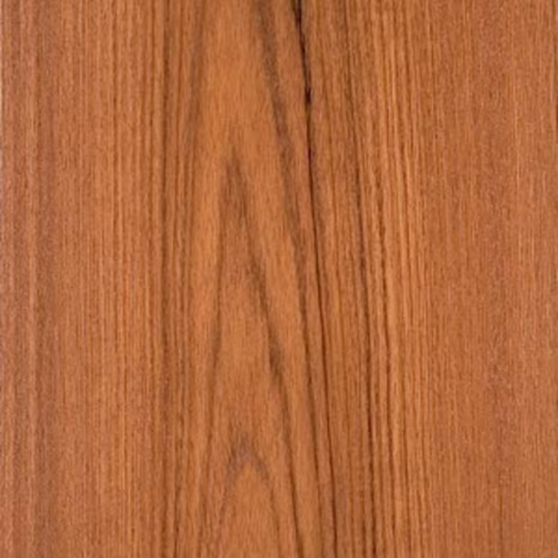 Extensive Veneer Gallery