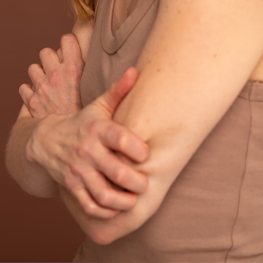Close up of a woman crossing her arms and scratching at her upper arms