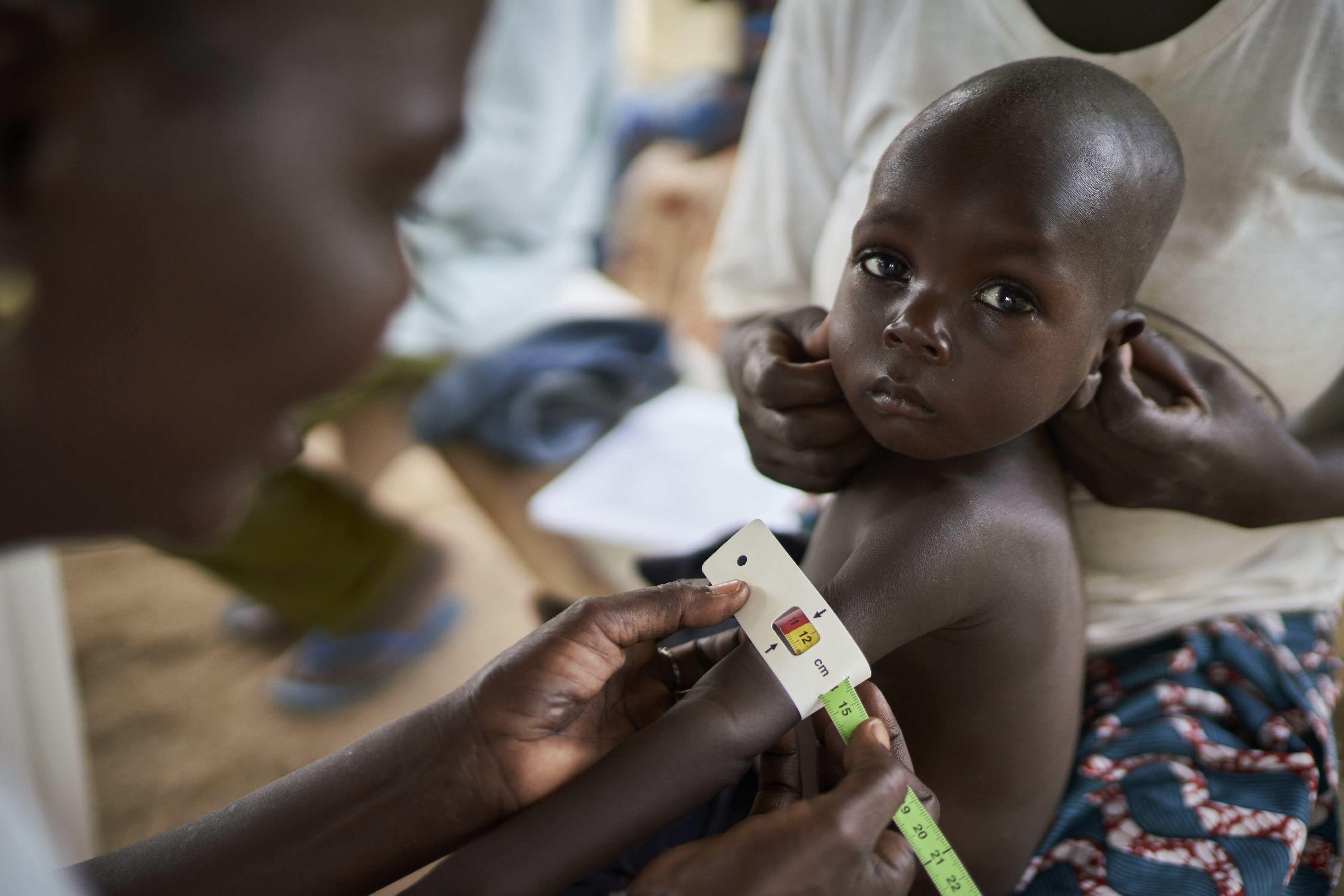 Examen malnutrition Cameroun