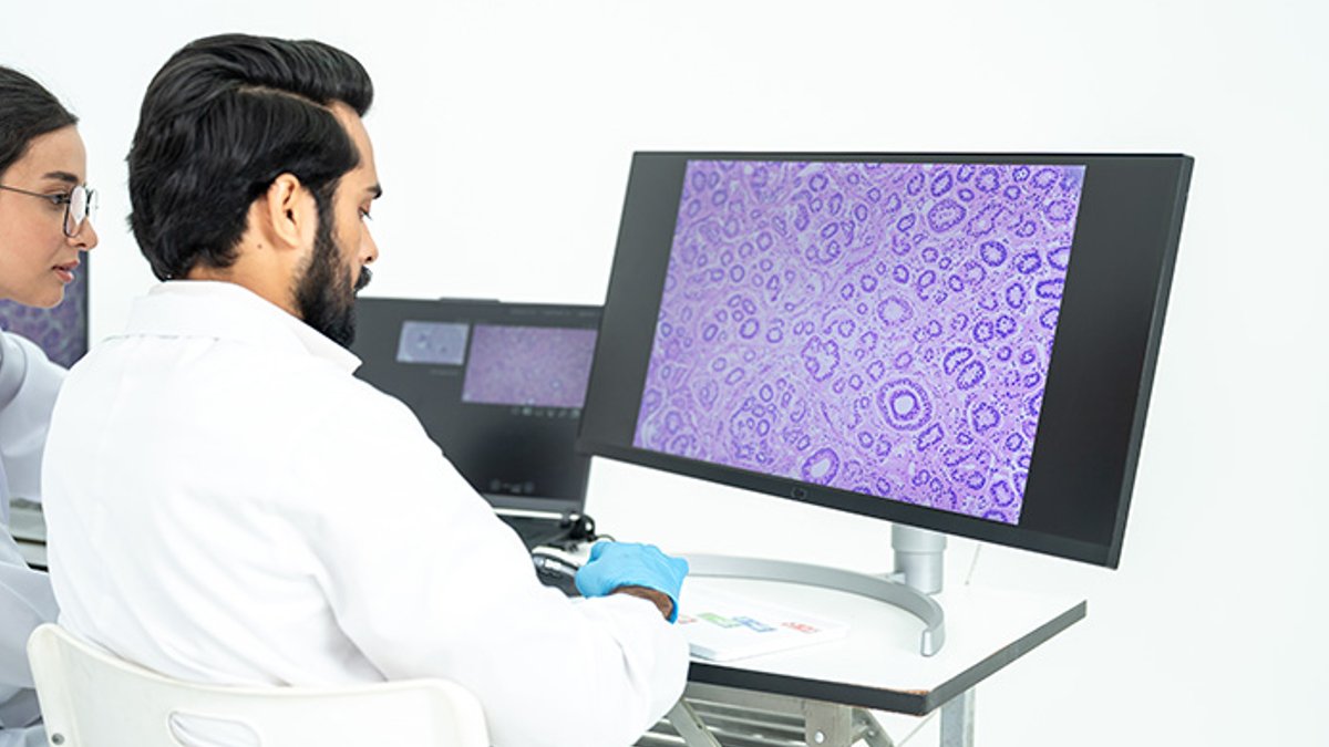 Researchers studying a purple microscopy image of cells on a large screen, digital pathology and histology analysis in bright