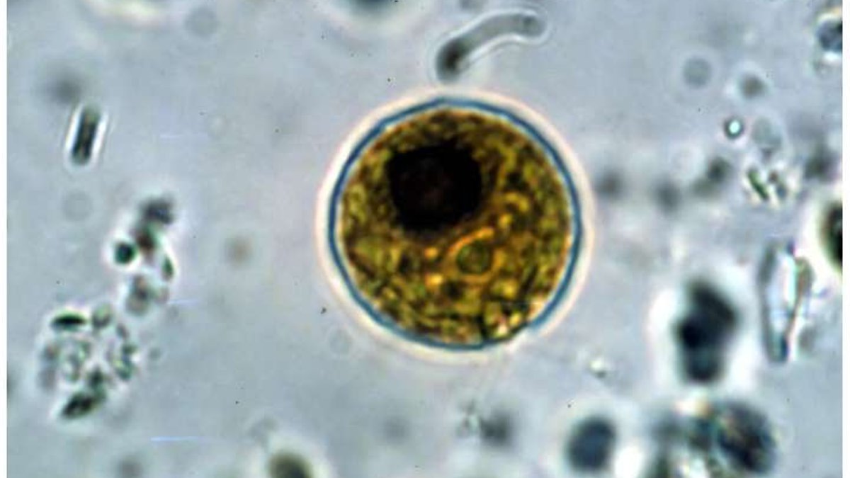 Algae Study Leads to 2026 Nobel for Optogenetics Light micrograph of Chlamydomonas with two flagella just visible at bottom left.