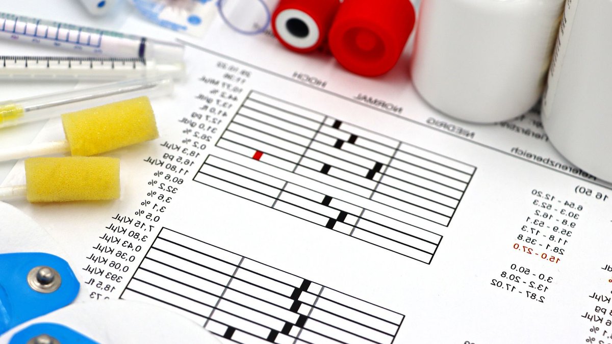 Arrangement of medical equipment, lab tests, and health data on a clinical table.