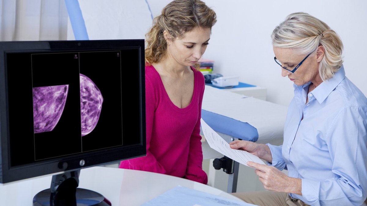 Mayo Clinic outlines when to consider preventive breast cancer surgery - preventive breast cancer surgery