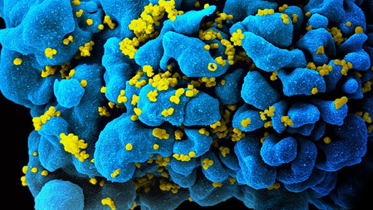 Colorized scanning electron micrograph of an HIV-infected T cell. *Image.