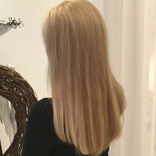 Genetisch bedingter Haarausfall