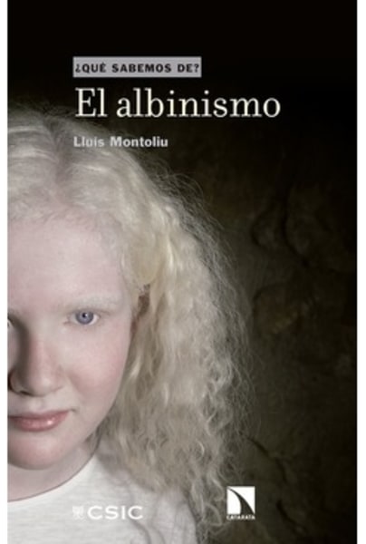 El albinismo