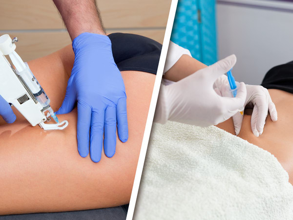 Combate la grasa y celulitis con mesoterapia