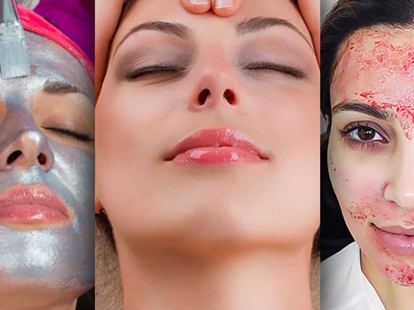 Lo último en tratamientos faciales para una piel perfecta (probado y aprobado por las famosas)