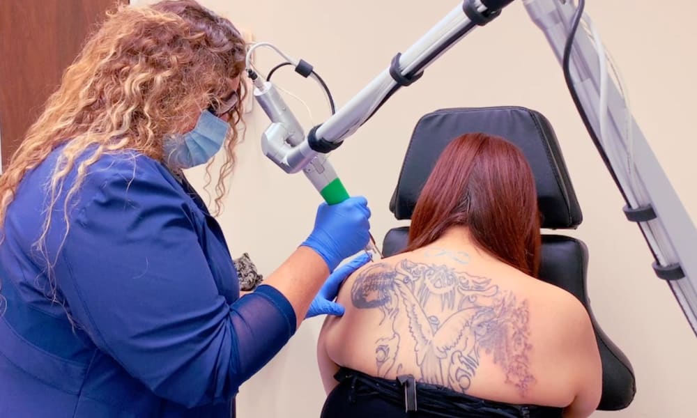 New Skin launches campaign to remove tattoos in 10 cities  Jails to Jobs