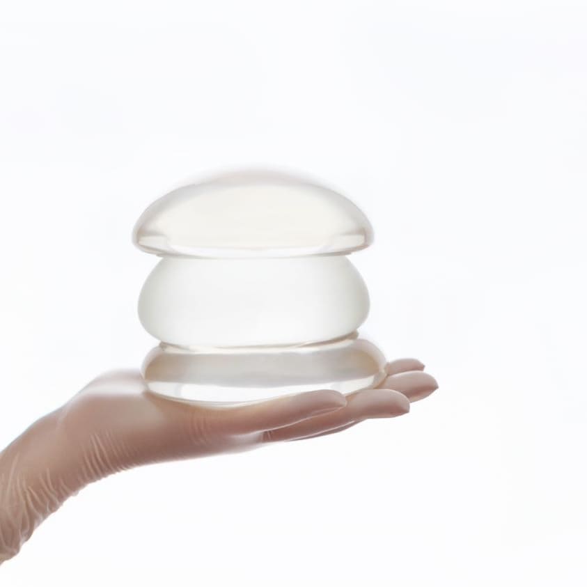 What Happens When You Have Breast Implants Removed