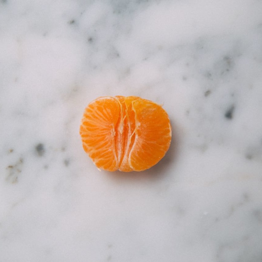 What It's Really Like To Get Labiaplasty