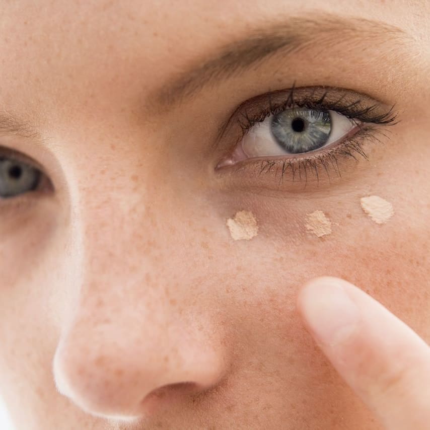 Injectable And Laser Bruising: How To Prevent, How To Conceal, How To Deal