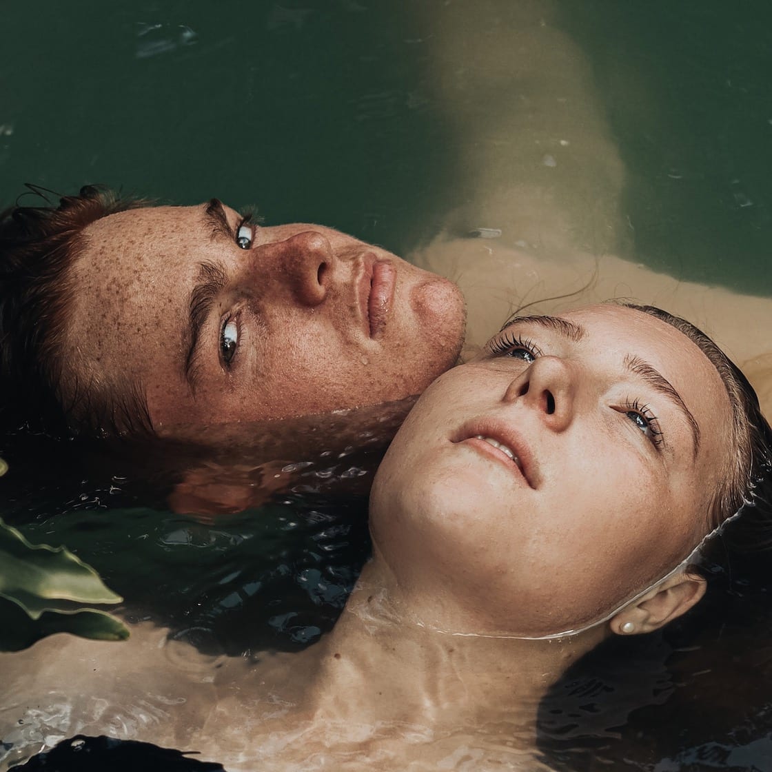 How Familiar Are You With These Forehead Treatment Options?