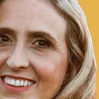 Lower Eyelid Malposition - Lateral Canthal Suspension Canthopexy