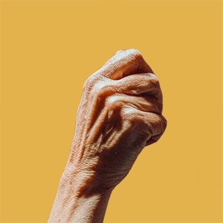 Hand Rejuvenation with Fat Transfer