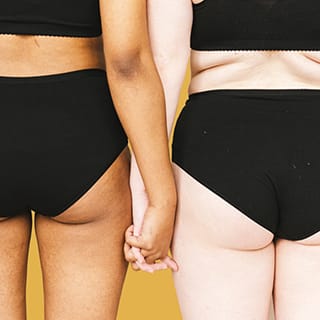 Butt Augmentation with Implants