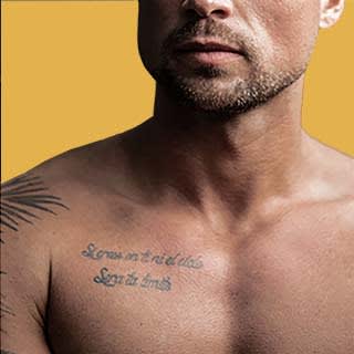 Laser Tattoo Removal