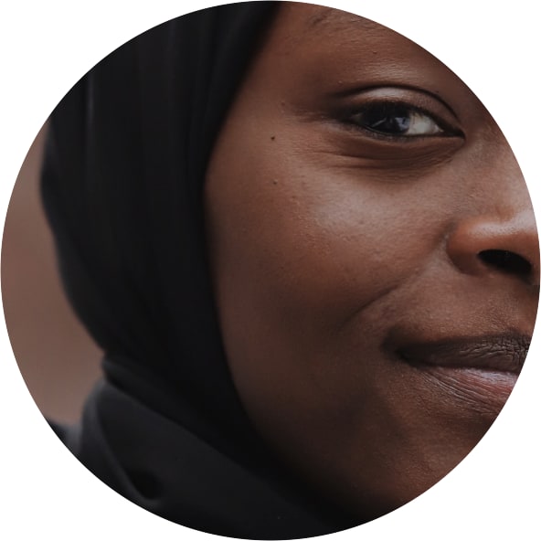 Thread Lift Treatment