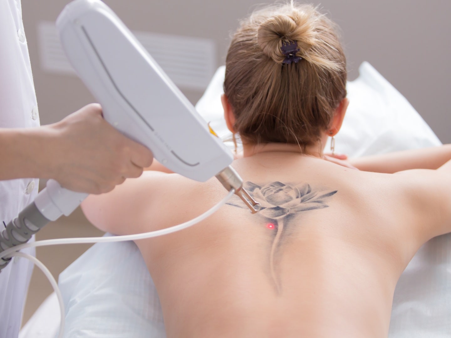 How laser hair removal affects tattoos  Australian Skin Clinics