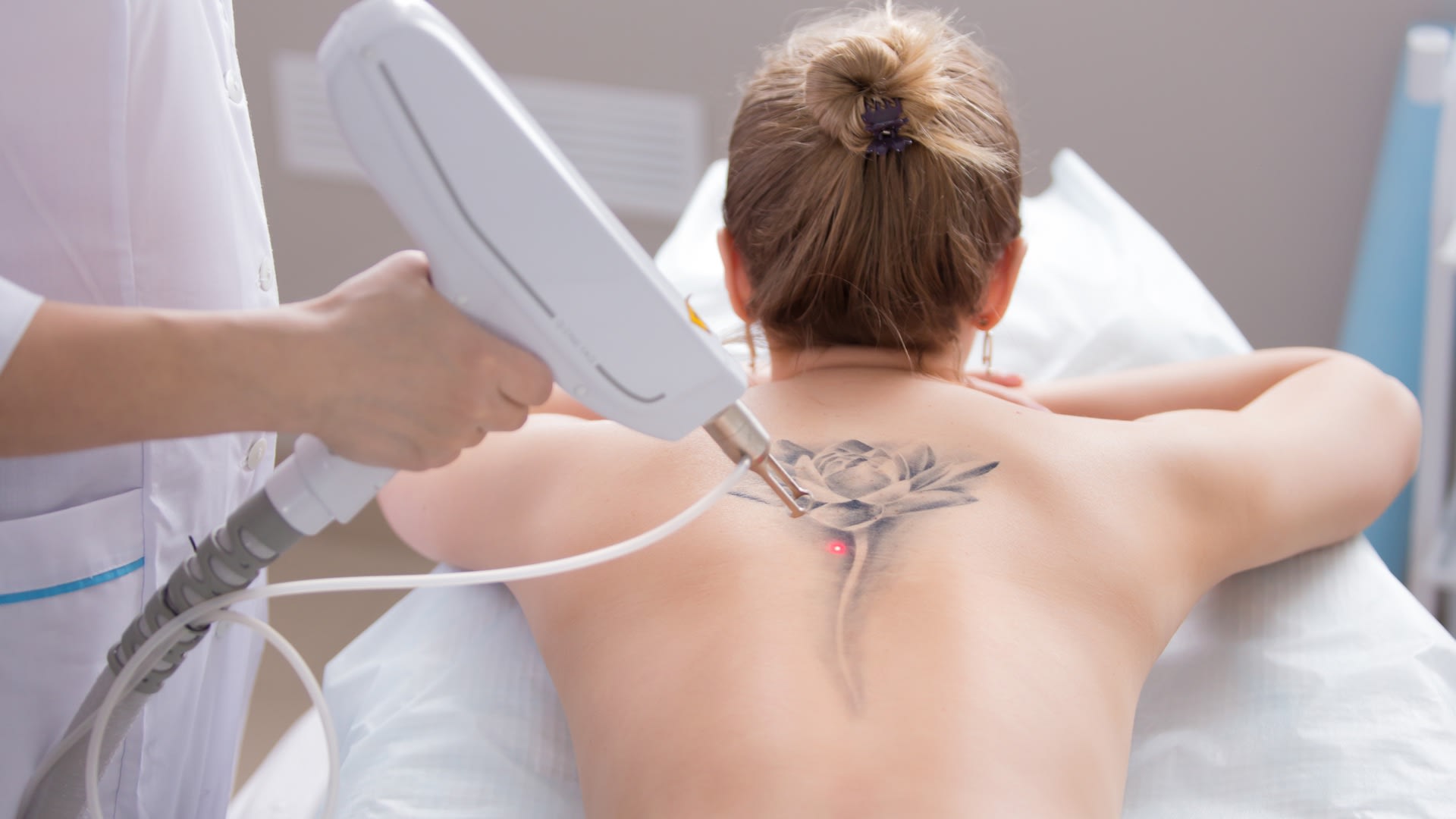 Tattoo Removal  Dermatology and Laser Centre of Los Angeles