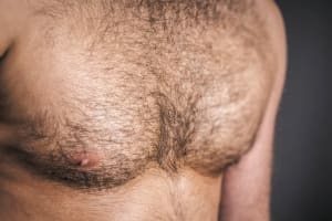 Here’s What You Need to Know About Body Hair Transplants