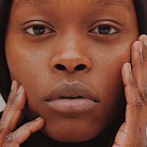 Thread Lift Treatment