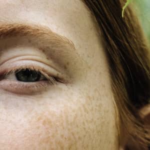 Dermaplaning Treatment